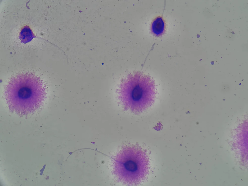 Sperm DNA Fragmentation Test Kit (SCD Assay) - sperminfo andrology product image 2